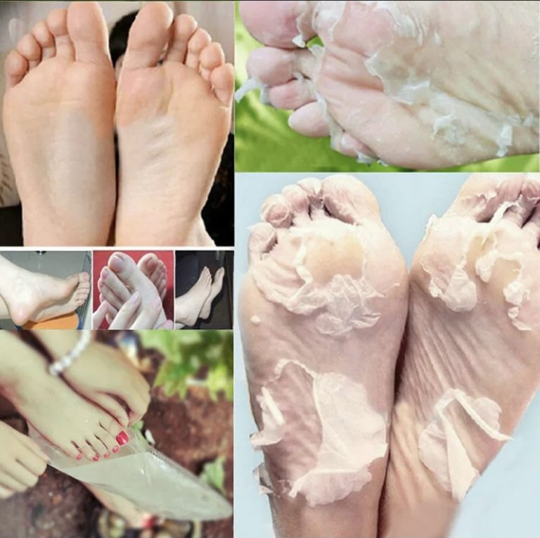 Foot & Callus Peel Treatment Sparkle Beauty Salon