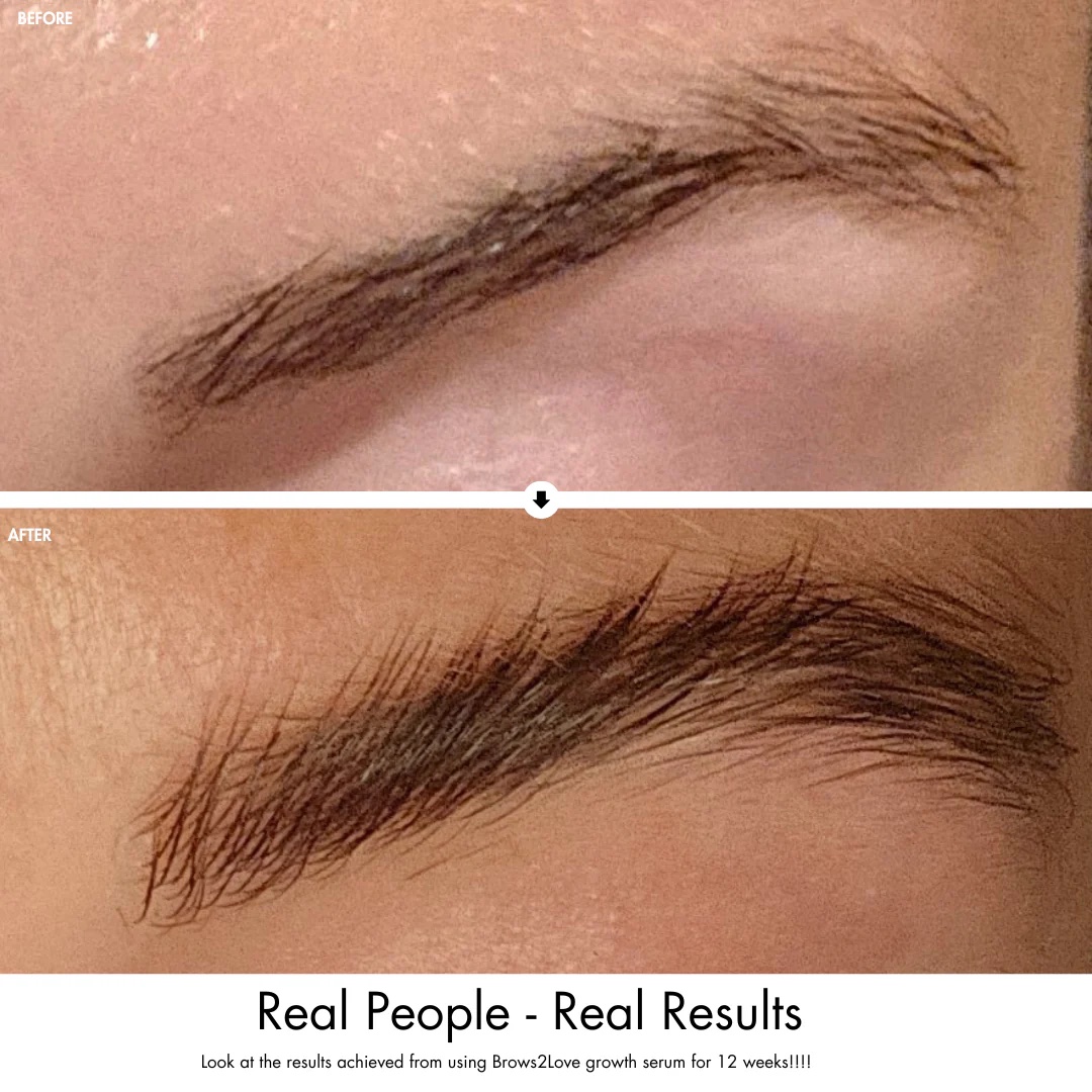 Brows2Love Brow Growth Serum - Image 2